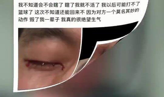 眼科专家谈郭艾伦：结膜受伤经处理大概率恢复得不错 不要太忧心